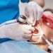 5 Tips to Choose the Right Orthodontist in San Francisco
